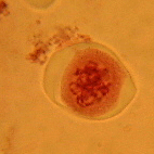 ��ꕪ���O��